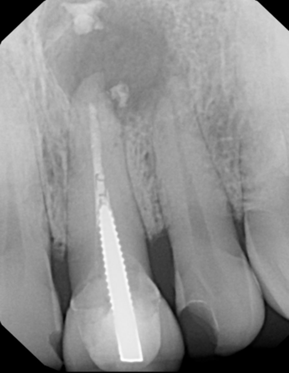 <p>ID the procedural error:</p>