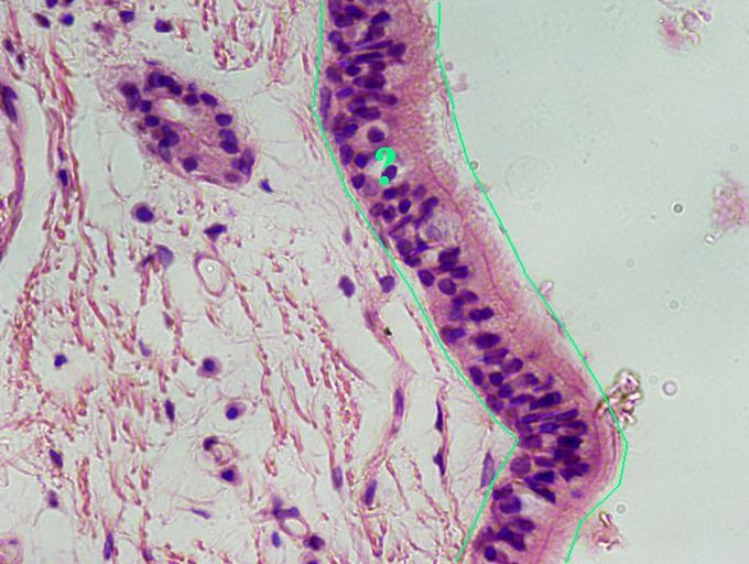 <p>pseudostratified columnar epithelium</p>