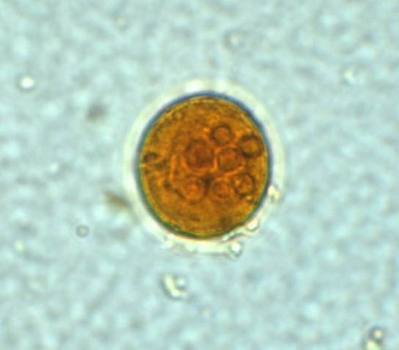 <p>up to 5-8 nuclei, slightly larger than E. histolytica cyst; splintered chromatoidal bar</p>