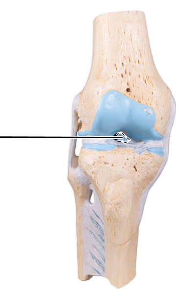 <p>What ligament is shown here?</p>