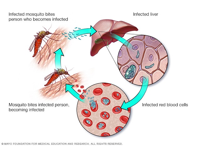 <p>mosquito bites person to infect them, travels through blood to liver, red blood cells are infected and will grow until bursting (causes fever), mosquito bites infected person and becomes infected - can now infect another person</p>