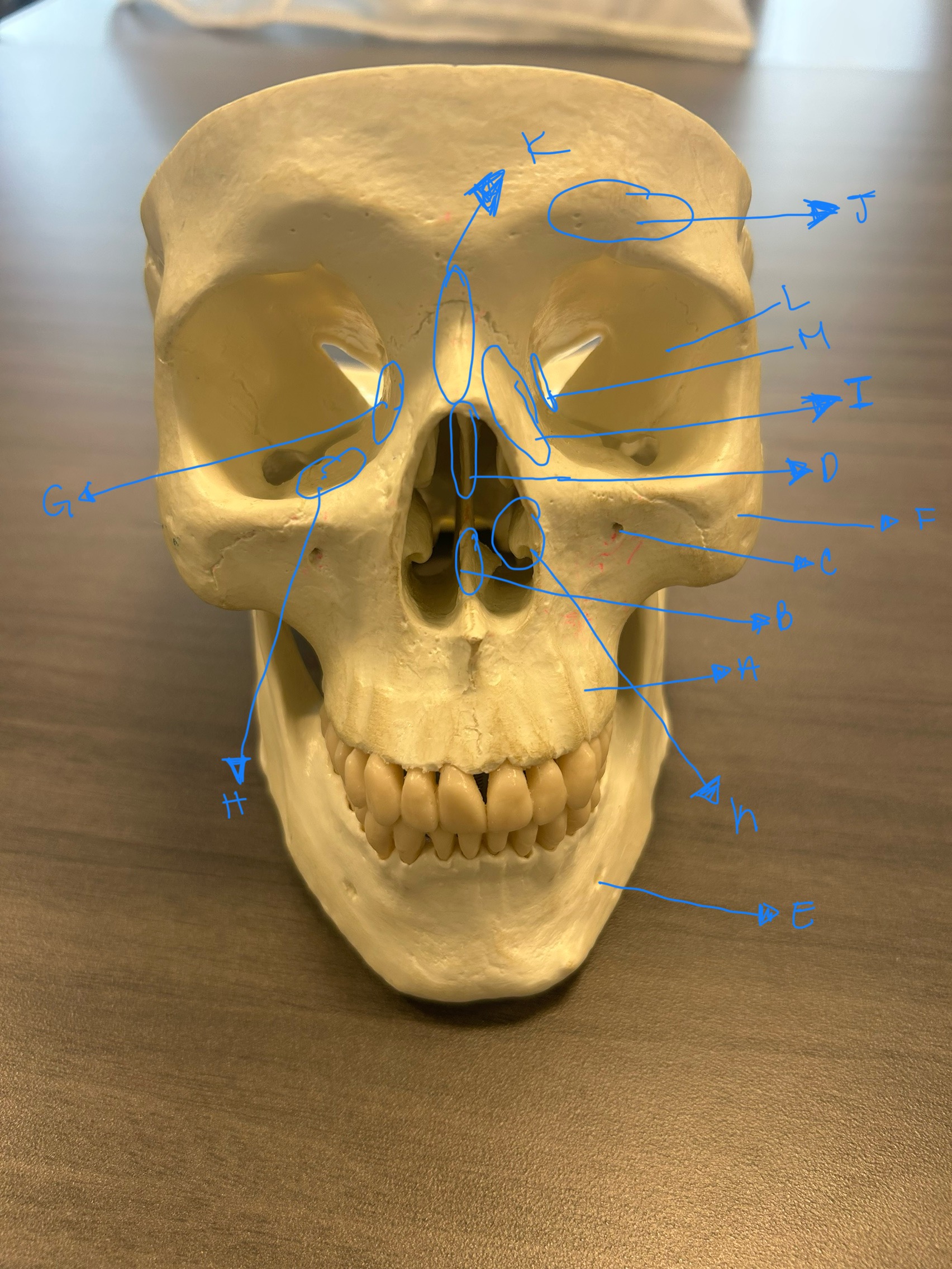 term image