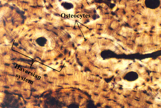 <p>Bone tissue (osteocytes)</p>