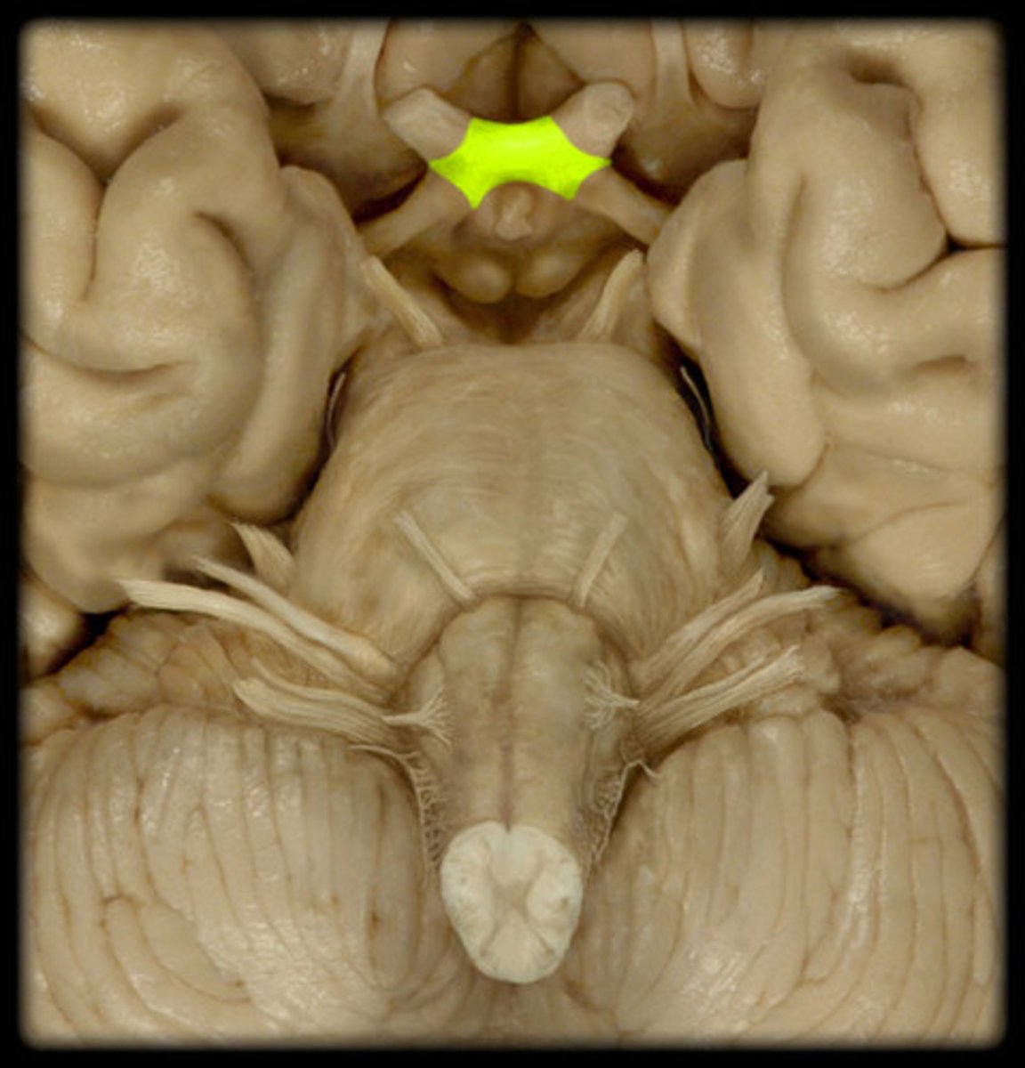 <p>point at which optic nerve fibers cross in the brain</p>