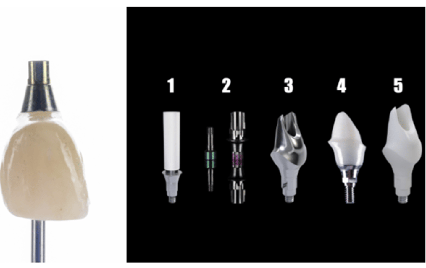 <p>The Picture bellow showed "most common implant restoration structure", which abutment was used for this restoration ? (Select one).</p><p>4</p><p>3</p><p>5</p><p>2</p><p>1</p>