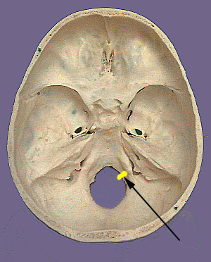 <p>Which bone landmark of the skull are tiny holes just above the foramen magnum?</p>