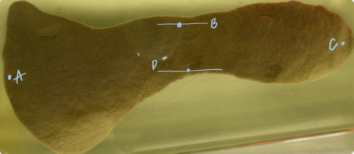 <p>D</p><p>(K9 spleen, parietal surface)</p>