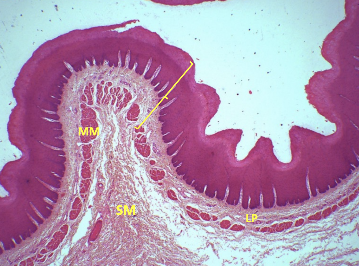 <p>Histology of Esophagus </p>
