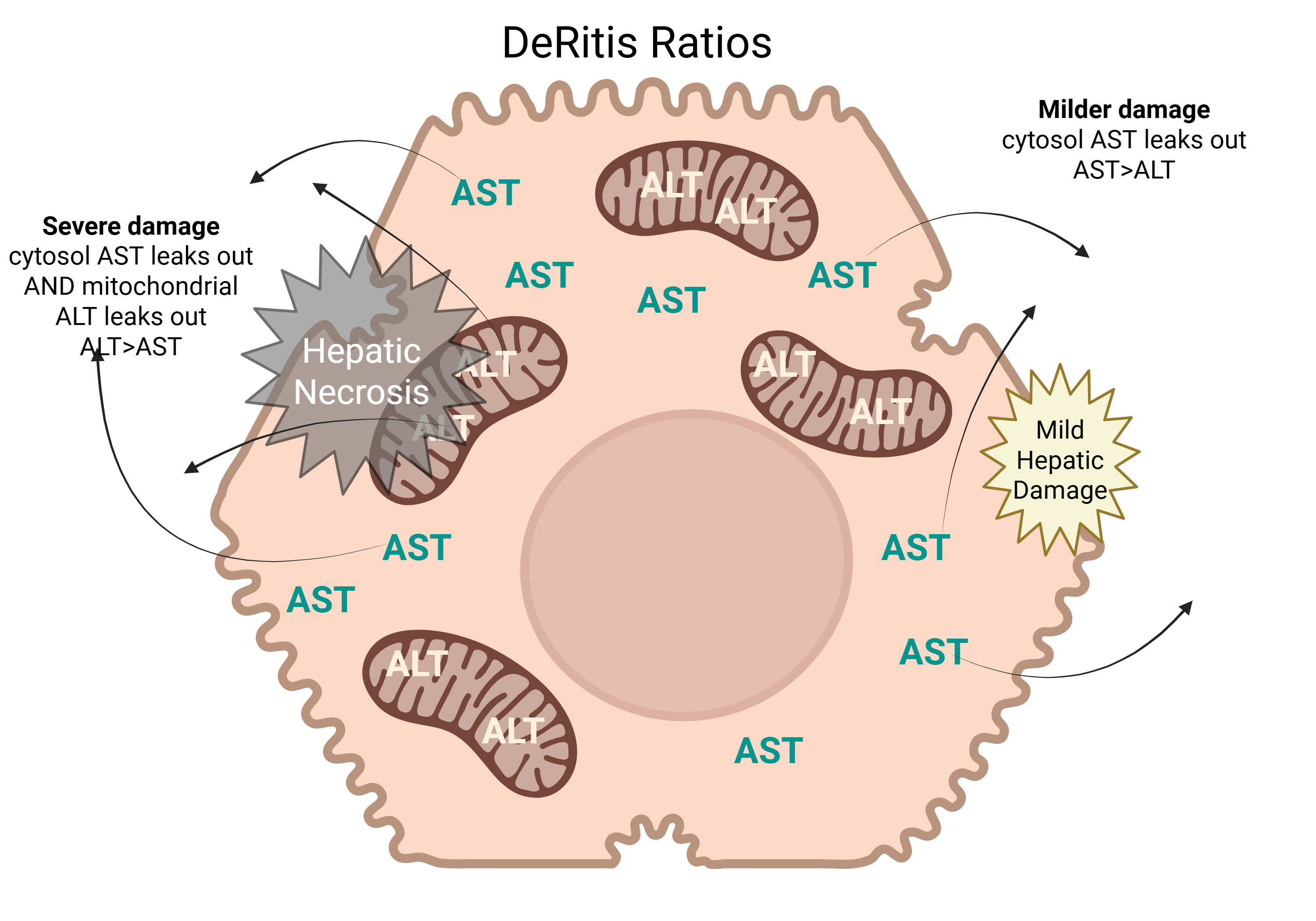 <p>Hepatic stress </p>