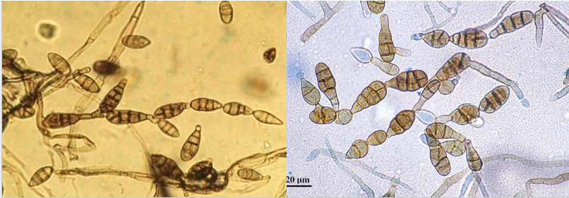 <ul><li><p><span><span>racket-shaped conidia are the characteristics identification feature, regardless of the arrangement</span></span></p><ul><li><p><span><span>AKA murifrom cells</span></span></p></li></ul></li></ul><p></p>