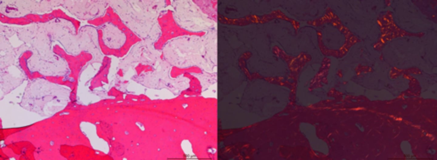 <p>Identify the pathology:</p>