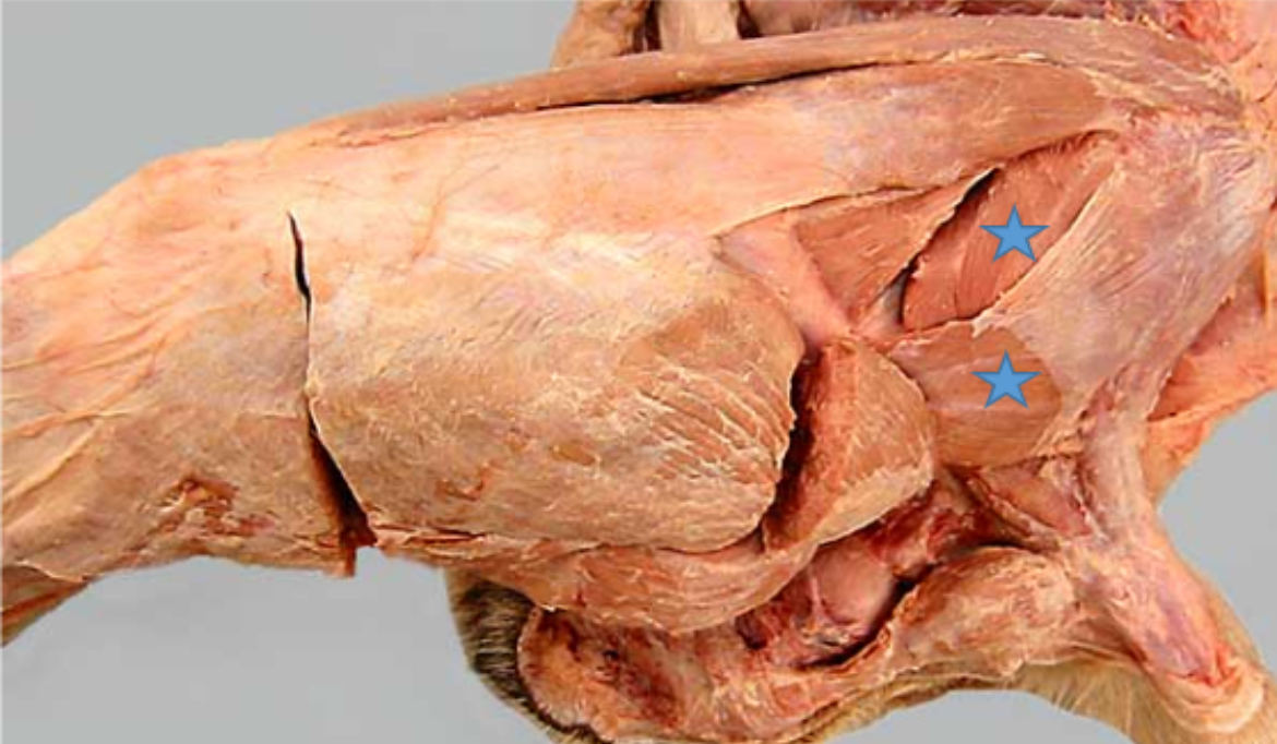 <p>Superficial, middle, and deep gluteal m</p>