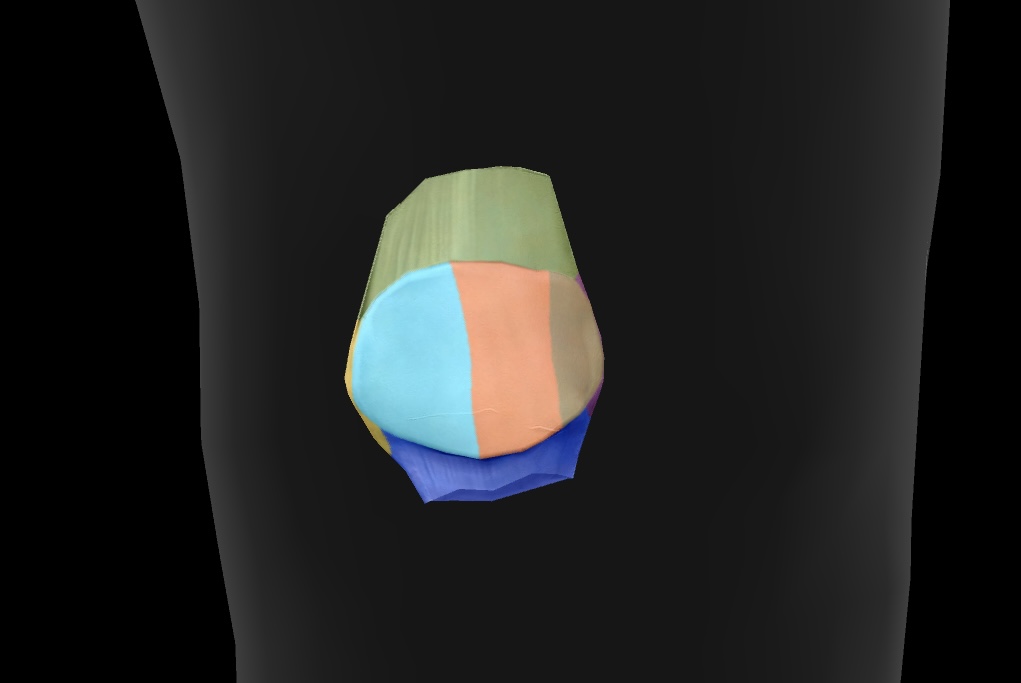 <p>The surface of the patella that articulates with the femur on the outer side of the knee joint. </p>