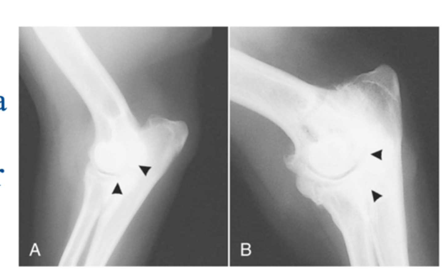 <p>significance of FCP- computed tomography (CT)</p>