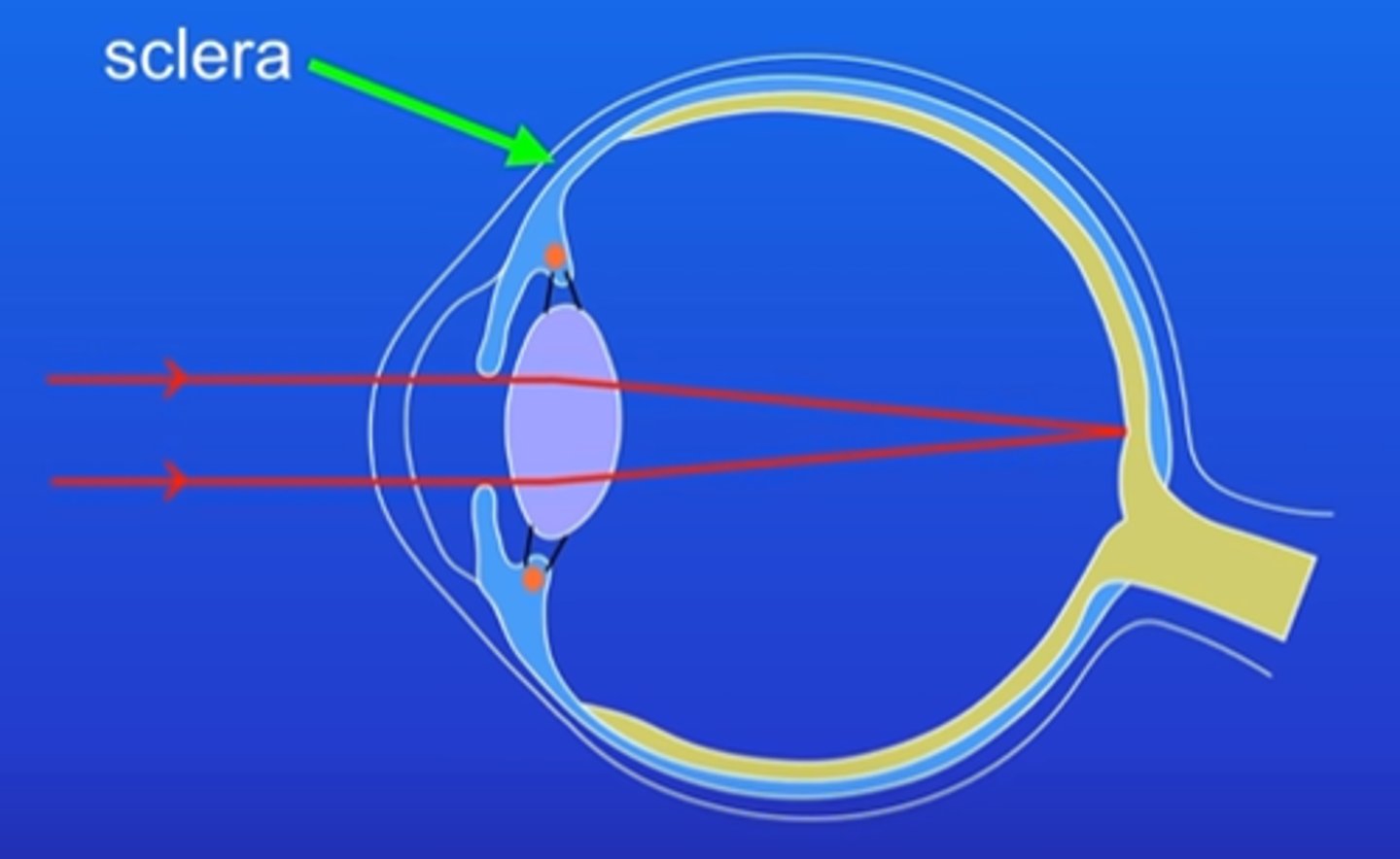 <p>tough white tissue the protects the eye from injury</p>