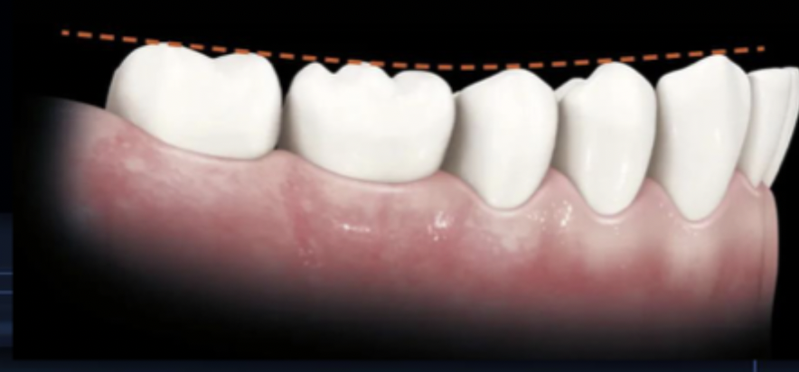 <p>the curvature which begins at the tip of the canines and follows the buccal cusps of the posterior teeth, when viewed from the facial; continues up the arch through the condyle</p>