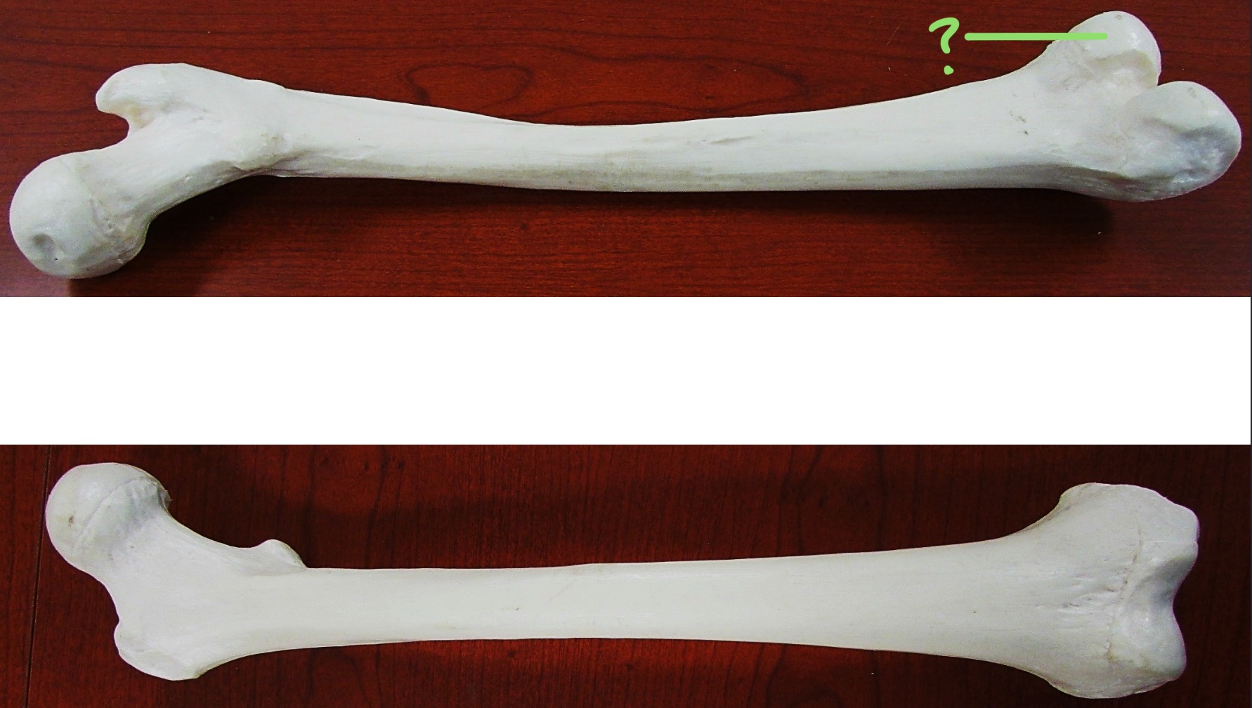 <p>Determine the part of the Femur highlighted</p>