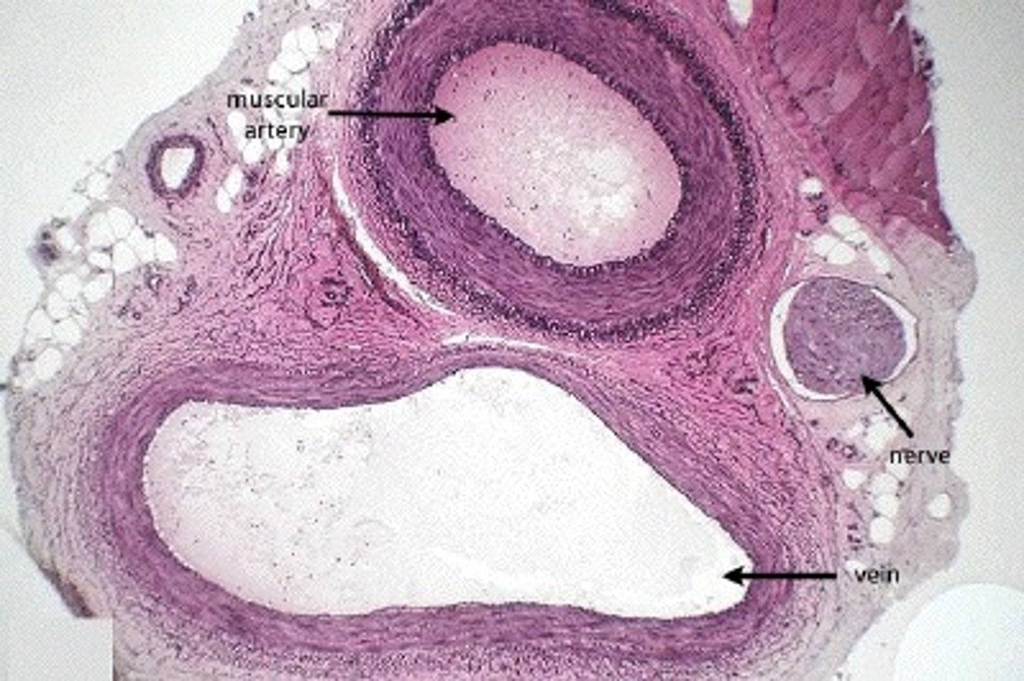 <p>carry blood away from the heart to capillaries; have thicker tunica media and narrower lumen than veins</p><p>Have more elastic and collagen fibers (spring back to shape)</p>