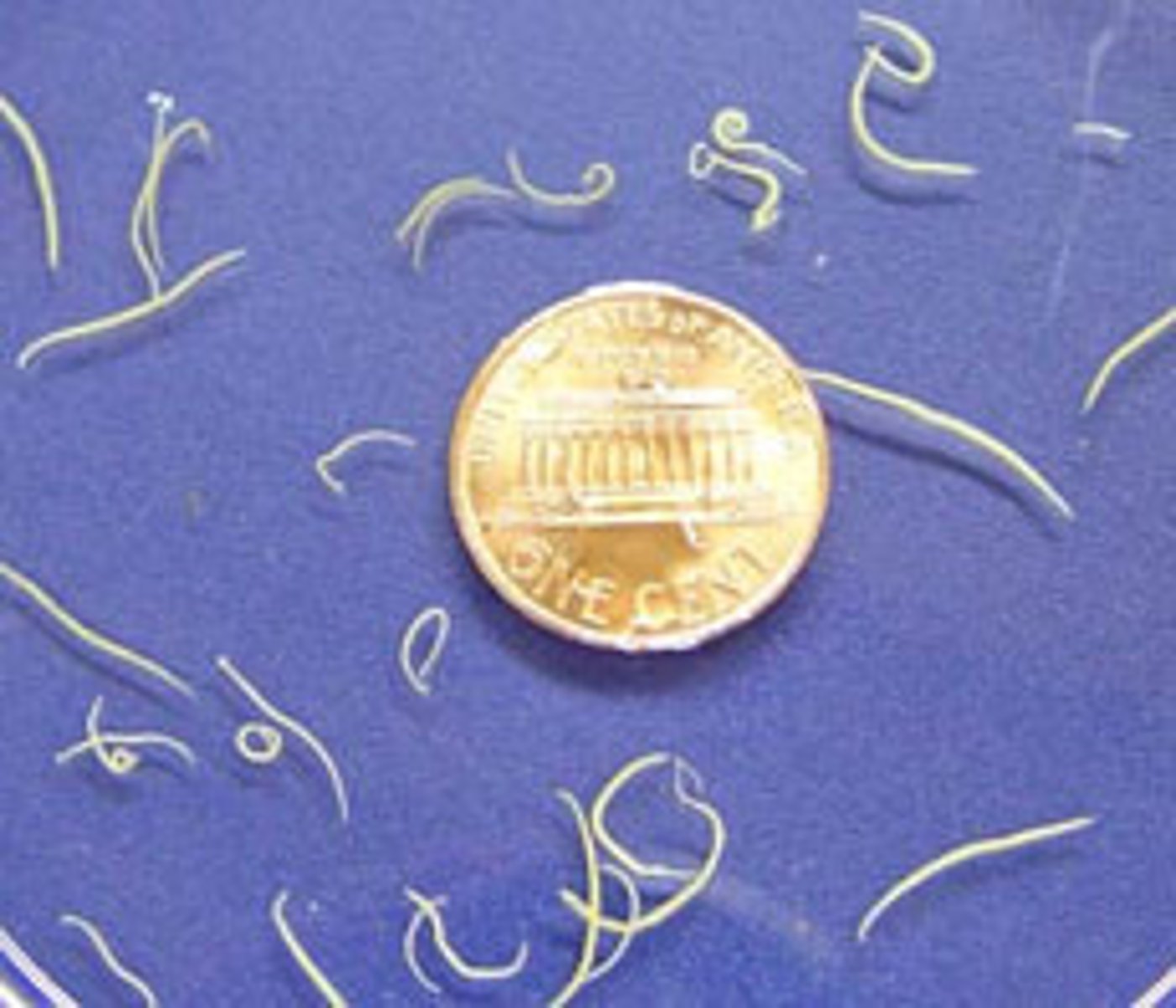 <p>enter through skin wound, suck blood and cause anemia</p><p>Tx albendazole</p>