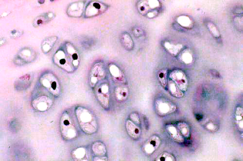 <p>What type of tissue is this (hint: aka hyaline)</p>