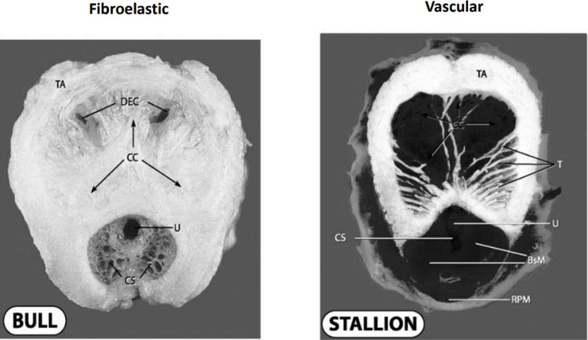 <ul><li><p>Vascular</p></li><li><p>Fibroelastic</p></li></ul>