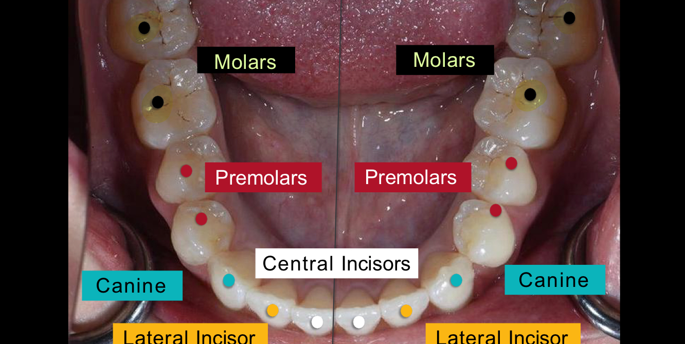 <p>Molars</p>