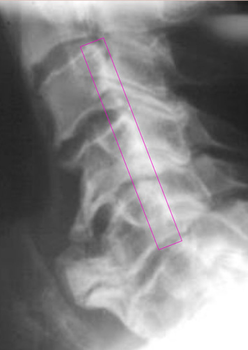 <p>What is the pink?</p>