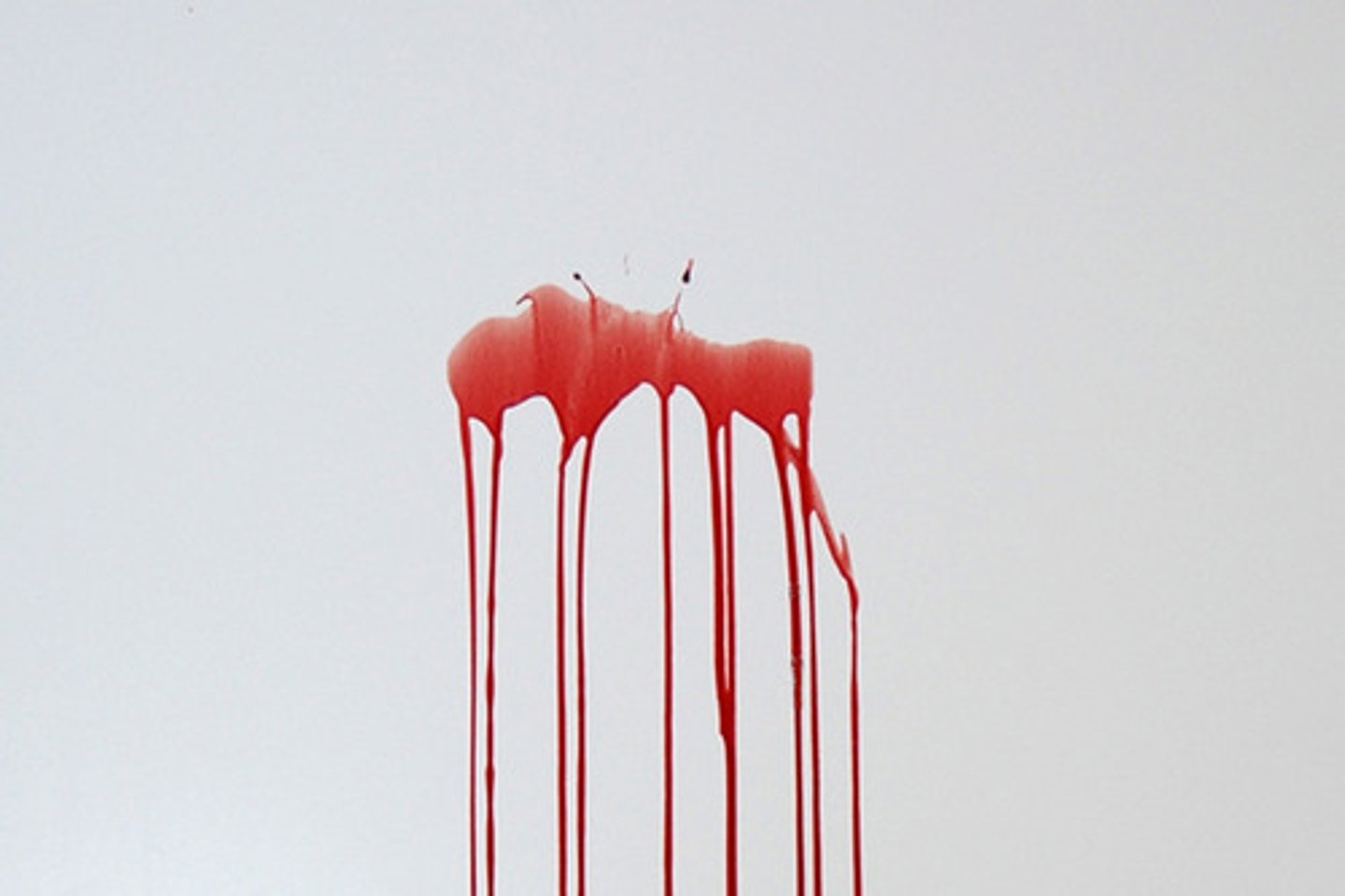 <p>Bloodstain pattern(s) resulting from blood exiting the body under pressure from a breached artery.<br><br>DESCRIPTION: This pattern was generated by drawing blood into a large-bore syringe and projecting it at the target.<br><br>The shape of arterial patterns can vary greatly but all deal with blood leaving the body under pressure. Patterns may have a series of large spurts as a result of larger wounds or they may be snake-like if the wound is smaller or restricted.</p>
