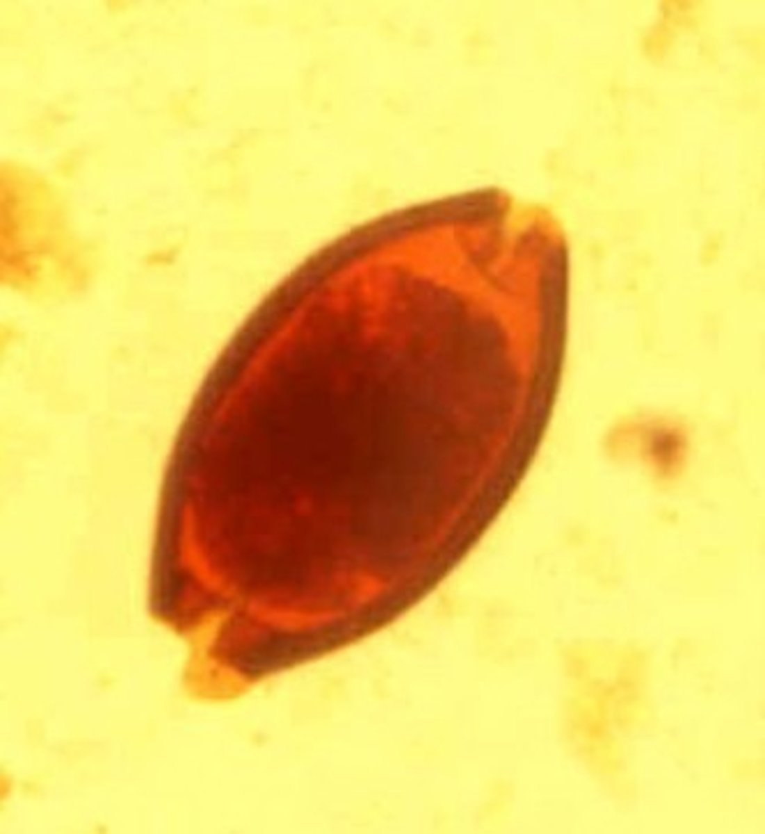<p>Identify the parasite</p>