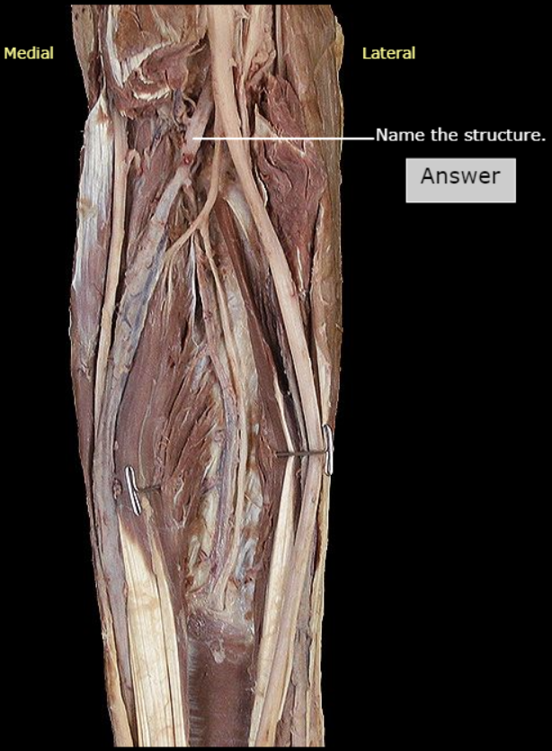 <p>What artery is this</p>