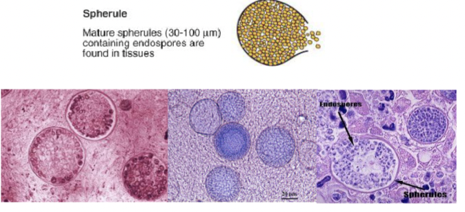 <p>Mature spherules are filled with endospores and are found in tissue</p>