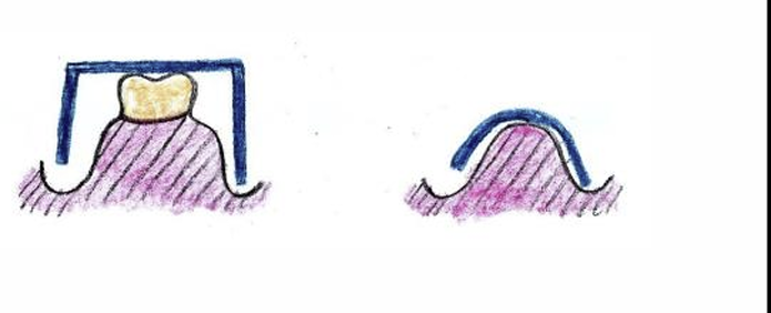 <p>How are these two images different?</p>