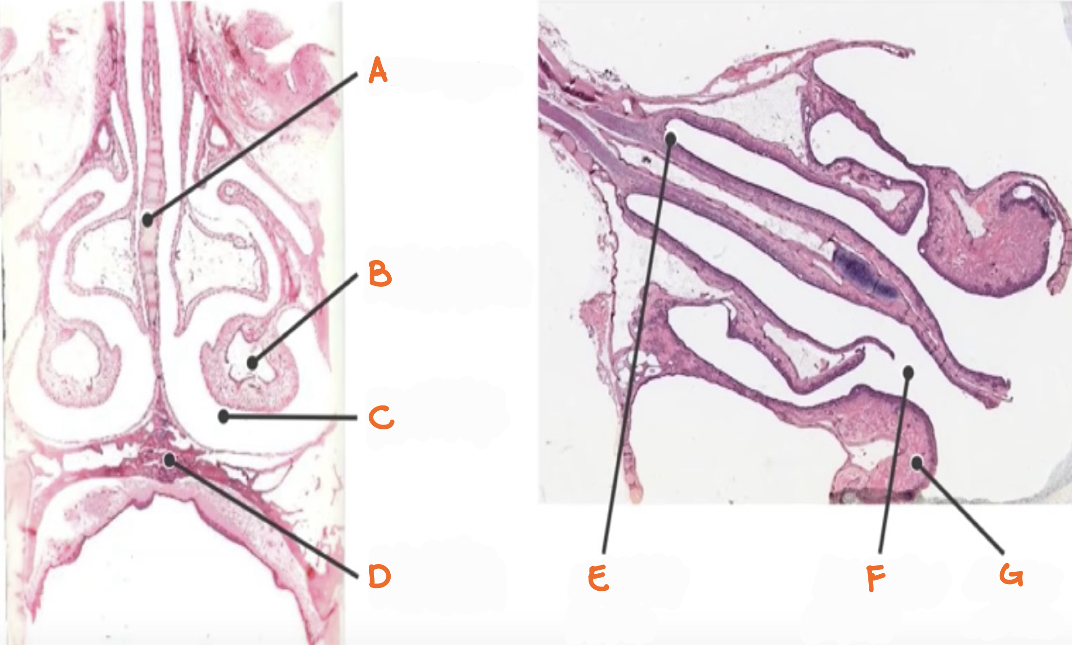 <p>Identify the structure</p>