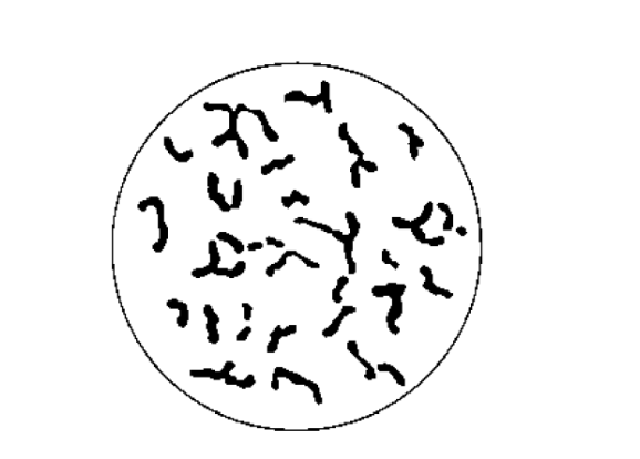<ol><li><p><em><u>Erysipelothrix rhusiopathiae</u></em> </p></li><li><p>Filaments</p></li><li><p>Chronic lesion</p></li></ol><p></p>