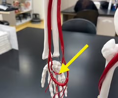 <p>Name the blood vessel.</p>