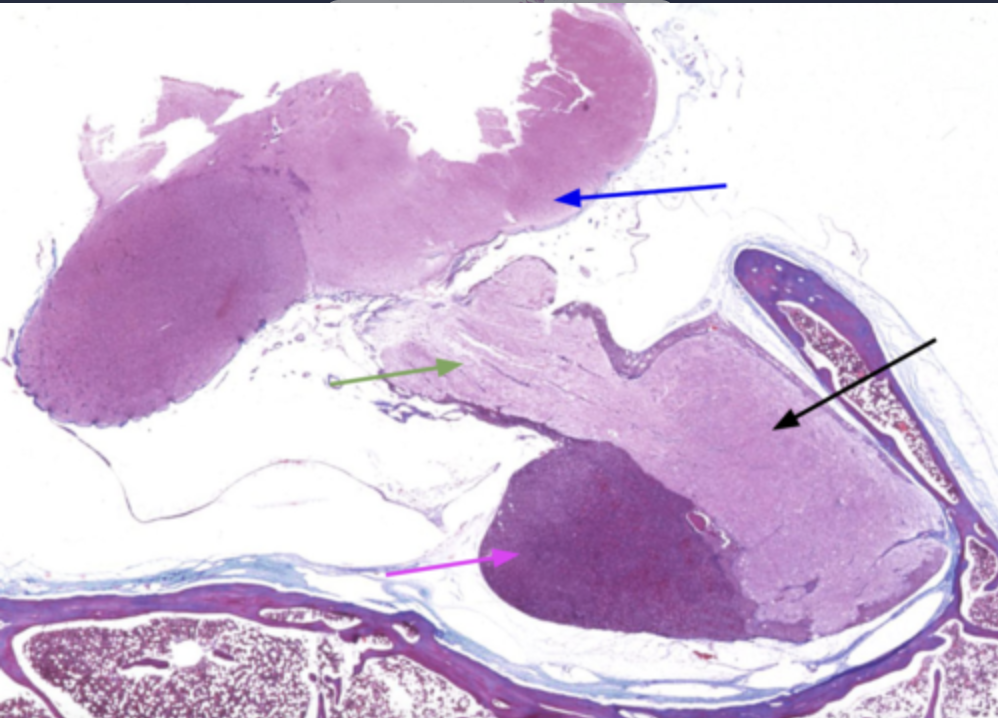 <p>What is the black arrow pointing to?</p>