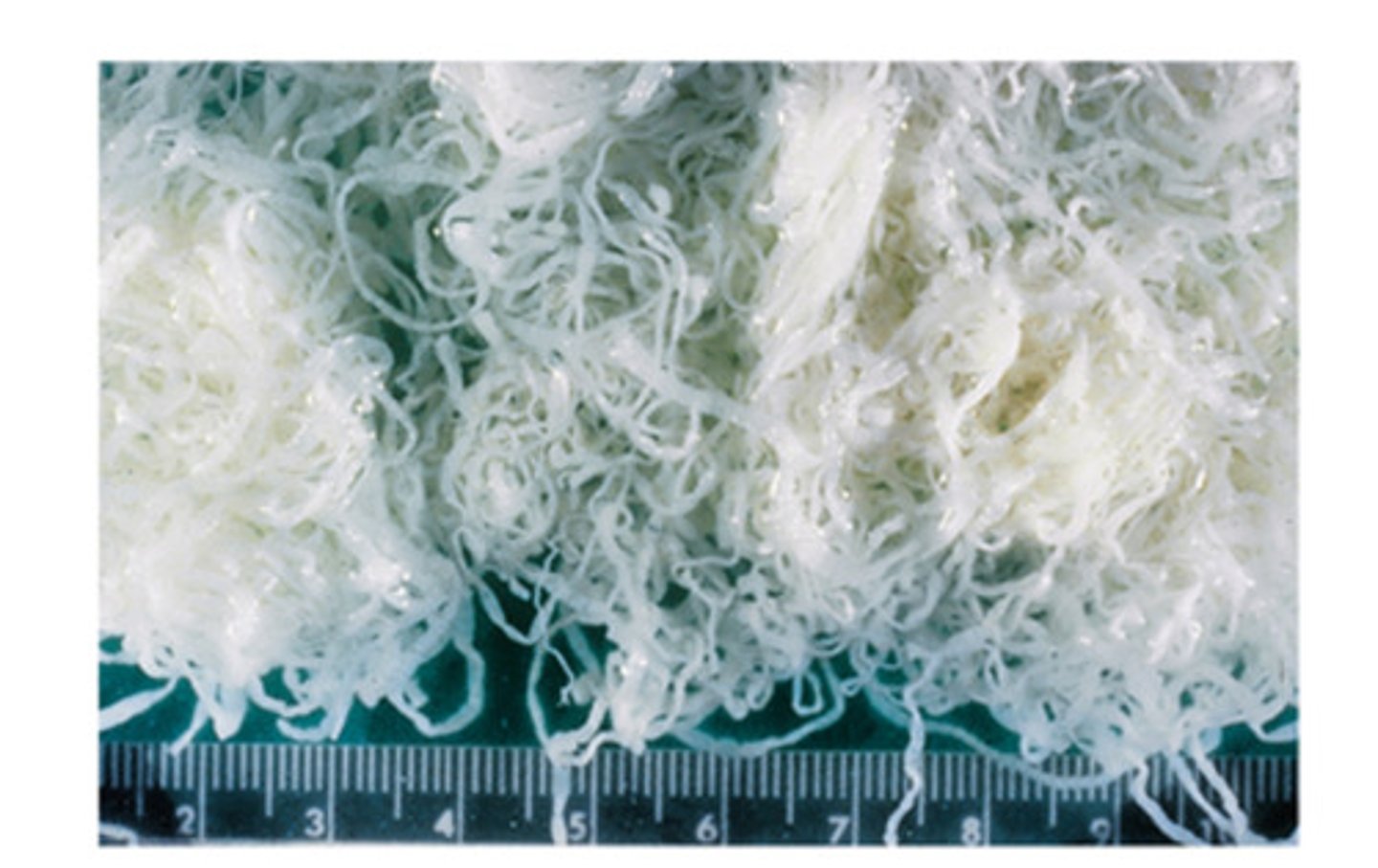 <p>The adults of this tapeworm range from 12cm to over 2m long and use the ordination mite as a first intermediate host and the mouse or rat as the second. What canine or other carnivore tapeworm is this?</p>