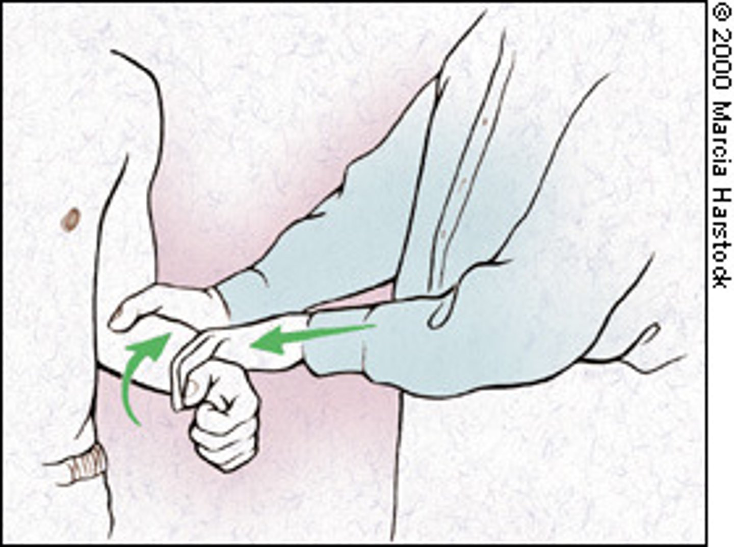 <p>Assess the stability of biceps tendon in bicipital groove</p><p>- pt flexes elbow to 90 while physician grasps elbow w/ one hand and wrist other pull and physician resists supination of forearm + external rotation of shoulder</p><p>(+) Test = pain as biceps tendon pops out of bicipital groove</p>