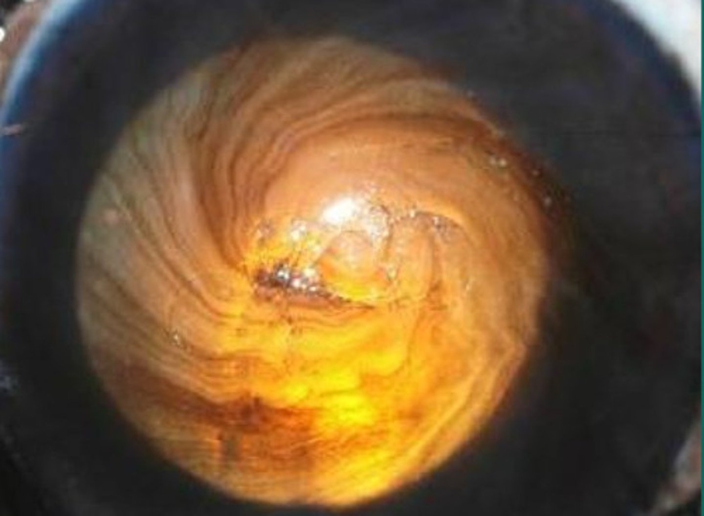 <p>What does this pattern mean?</p>