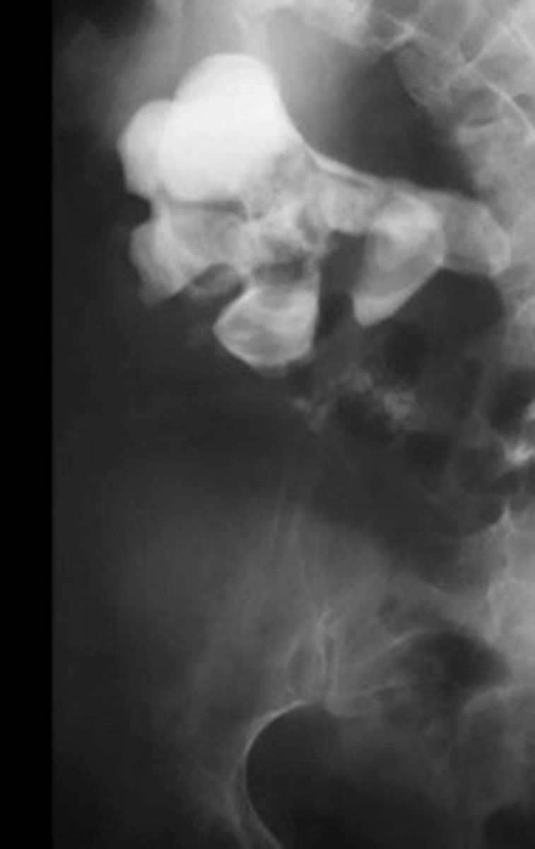 <p>What does this image show</p>