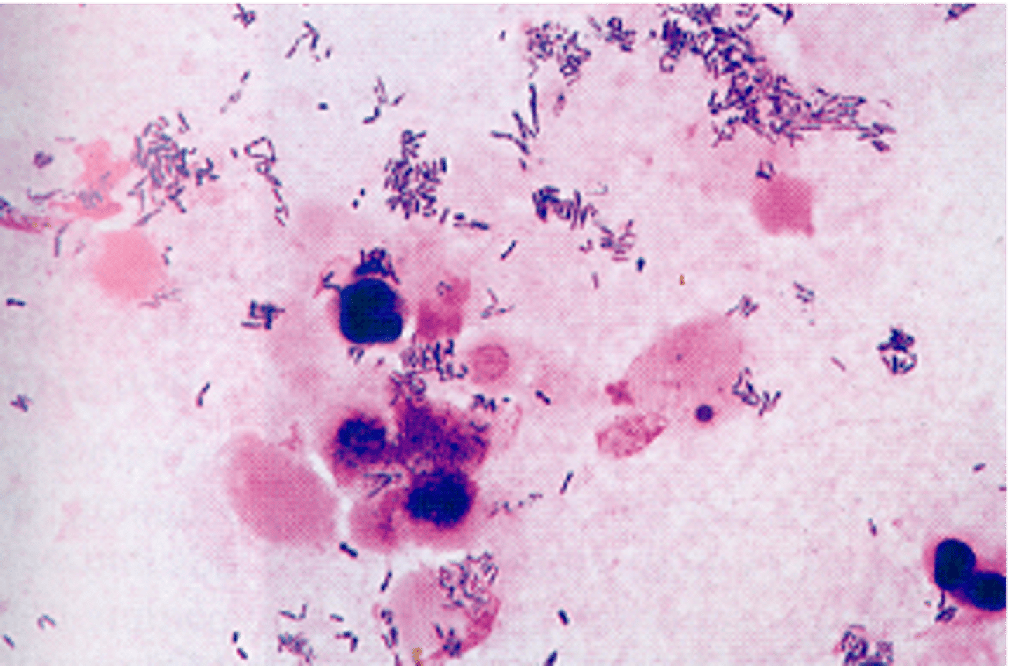 <p>what disease can this pathogen cause</p>