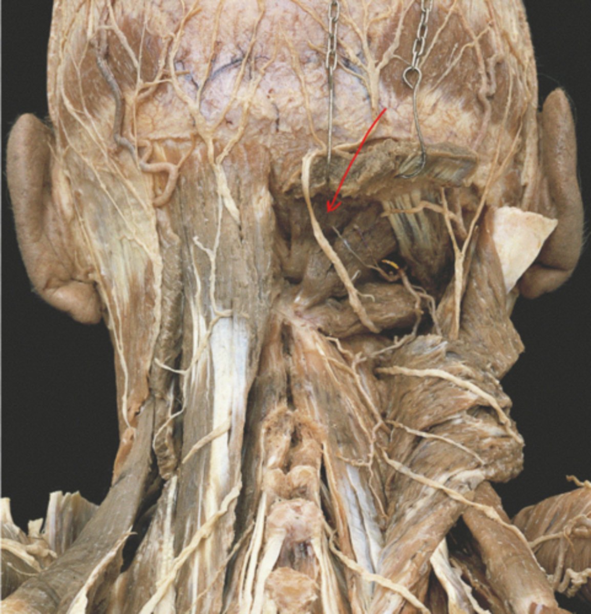 knowt flashcard image