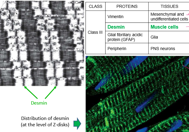 <ul><li><p>Vimentin: Mesenchymal and undifferentiated cells (but can also be expressed in differentiated cells… WHEN THEY’RE CANCEROUS!)</p></li><li><p>Desmin: muscle cells, localized by alpha actinin, so in z-disks</p></li><li><p>Glial fibrillary acidic protein (GFAP) in glia</p></li><li><p>Peripherin in PNS neurons</p></li></ul><p></p>