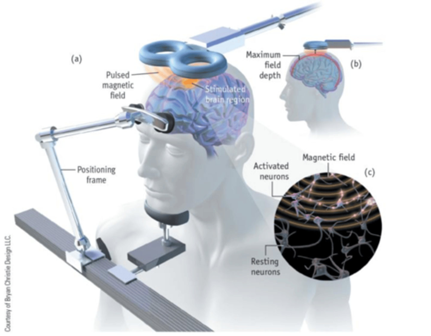 <p><strong>2. Transcranial Magnetic Stimulation (TMS): </strong></p><p>Uses focused magnetic field: pulses to stimulate neural activity in targeted regions of the brain </p><p></p><p>Depending on strength and timing of magnetic pulses you can alter action potentials: firing/communication between neurons in that specific region being stimulated</p><p></p><p>Manipulating neural activity, can TMS in specific area then look for corresponding changes in behaviour, then look at a secondary area and if corresponding changes aren't replicated then maybe its something about the first area of the brain that is implicated in some behaviour </p><p></p><p>- <strong>Can cause temporary enhancements or depression of neural activity depending on timing and duration of magnetic pulse has capability of temporary virtual lesion has different  applications</strong></p><p></p><p></p><p><strong>Drawback: TMS cannot penetrate deeper brain structures</strong>: outermost layer only (cerebral cortex) </p><p>Benefit </p><p><strong>Benefit</strong>: (TMS) offers a non-invasive method to establish causal relationships between brain regions and behavior by temporarily enhancing or suppressing neural activity, enabling targeted investigation of cortical functions and promising research applications, such as alleviating symptoms of depression.</p>