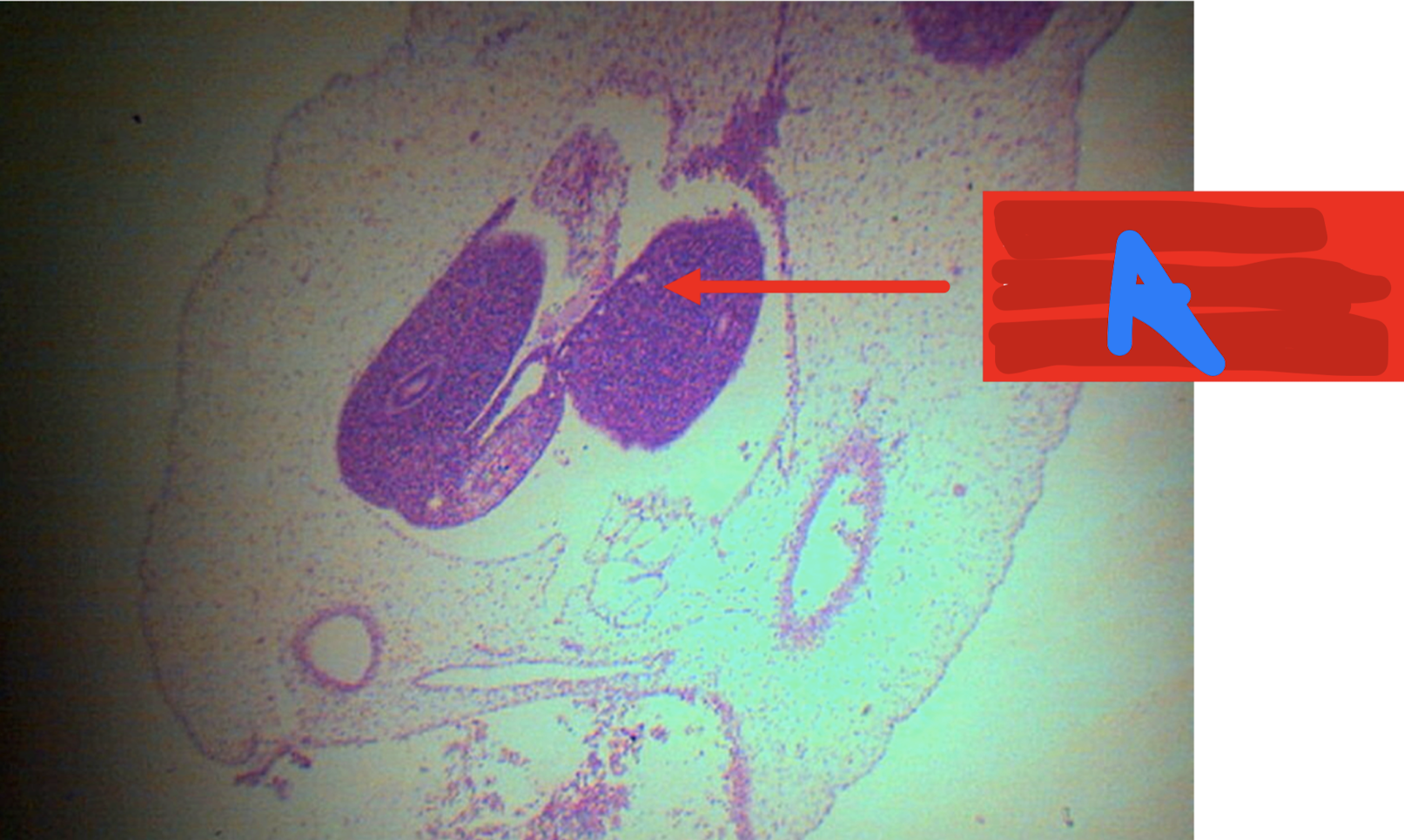 <p>Identify the structure; it returns back to the abdominal cavity at weeks _____</p>