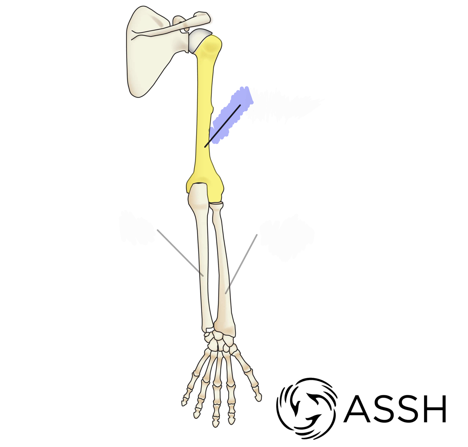 <p>head, neck, shaft, trochlea, capitulum, greater tubercle; lesser tubercle, olecranon fossa; Know right from left</p>