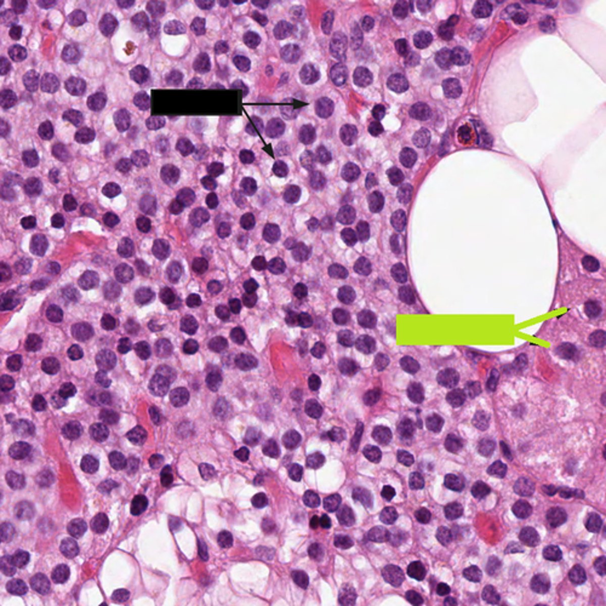 <p>What type of cell is the green box pointing to?</p>