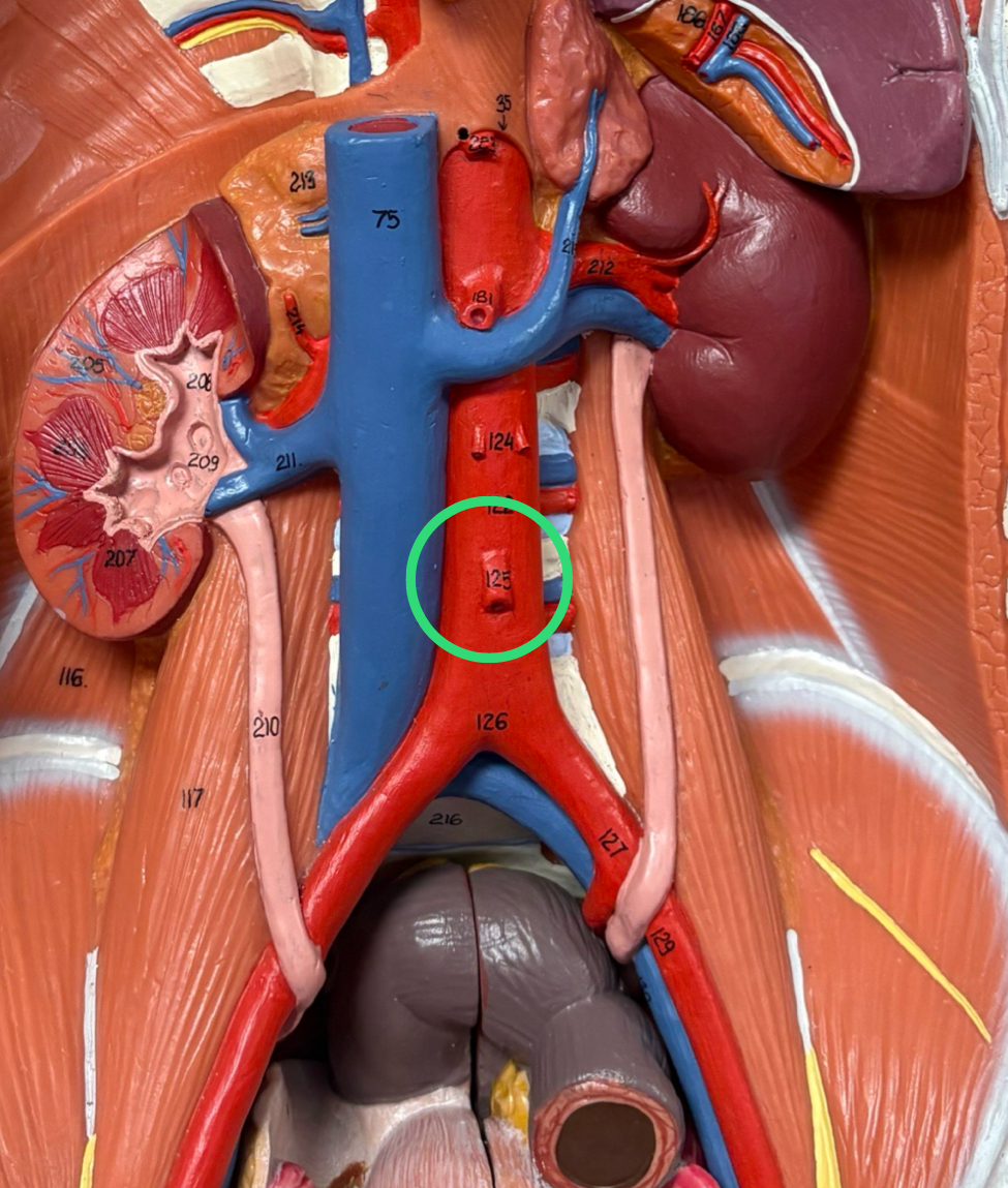 <p>large artery off abdominal aorta inferior to SMA</p>