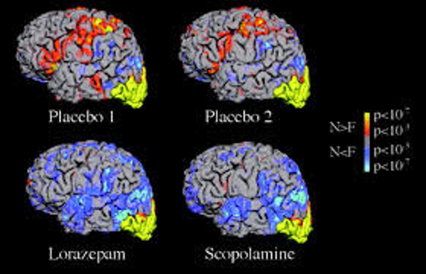 <p>fMRIs show brain activity in real time (pictures of where activity is happening). They work by the use of magnets which ping oxygen by neurons</p><p>(mostly in humans)</p>