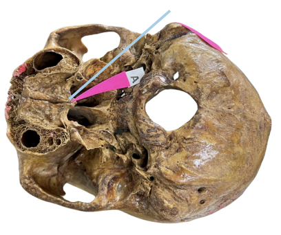 <p>Identify the structure of the skull labelled as A.</p>